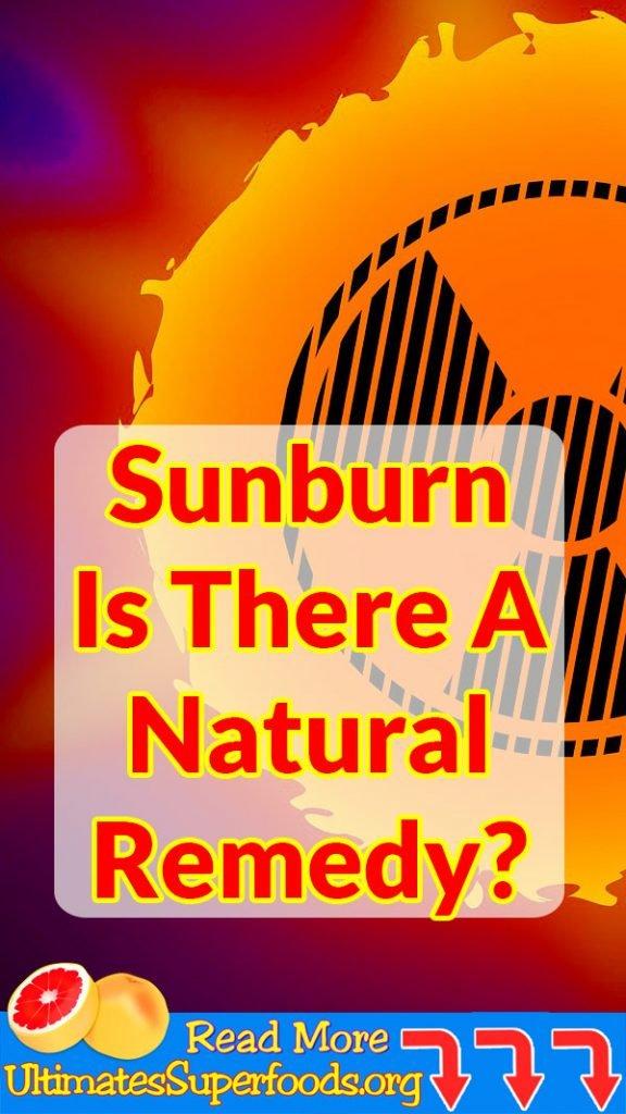 sunburn-remedy
