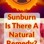 sunburn-what-can-i-do